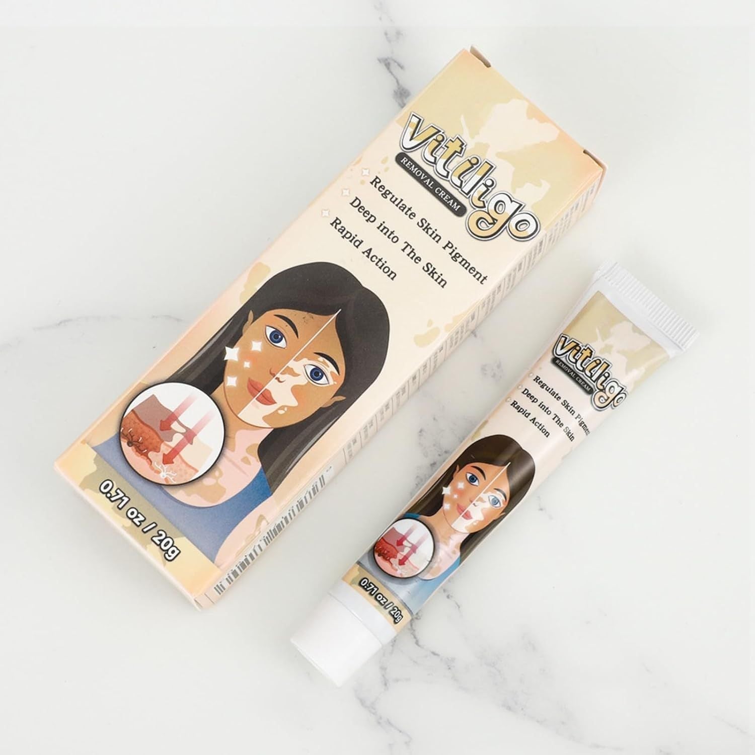 Vitiligo Removal Cream